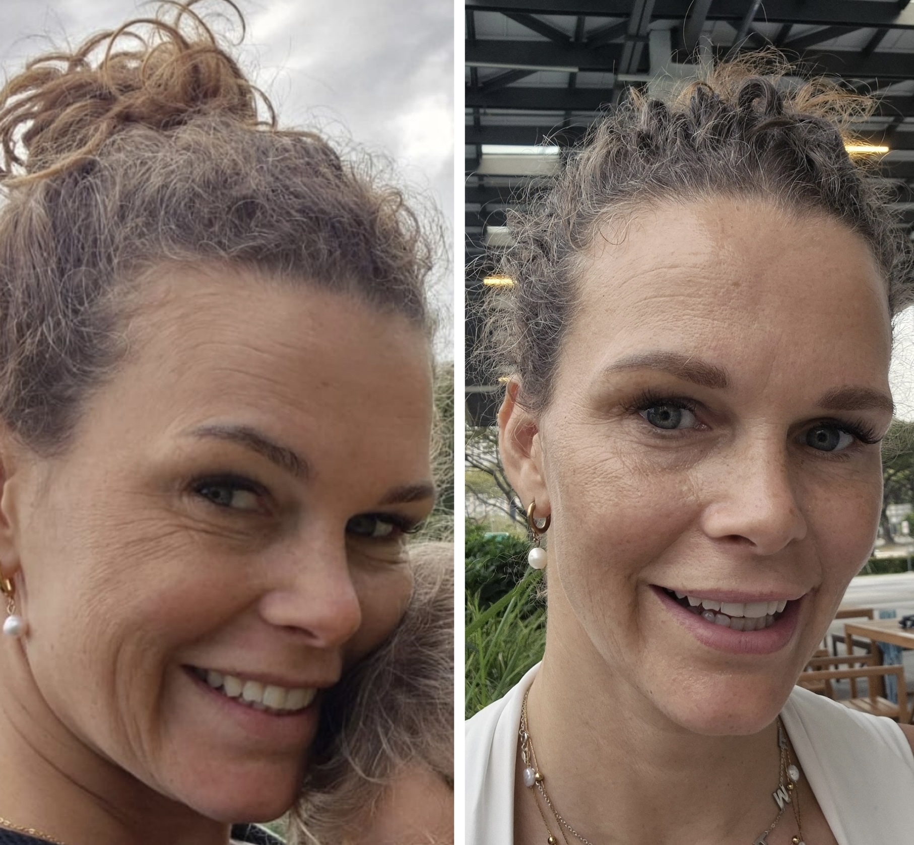 Before and after result